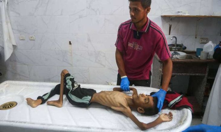 غزة تموت جوعا.. وفاة 15 فلسطينيا بسوء التغذية خلال 24 ساعة